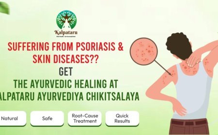 Psoriasis and Skin Diseases – The Ayurvedic Approach at Kalpataru Ayurvediya Chikitsalaya