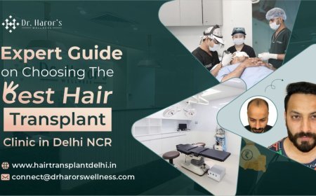 Expert Guide on Choosing the Best Hair Transplant Clinic in Delhi NCR